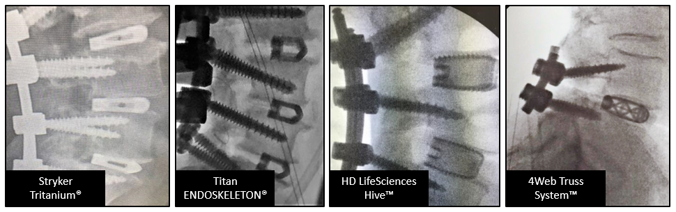 Figure 2 Radiographic images from tested devices